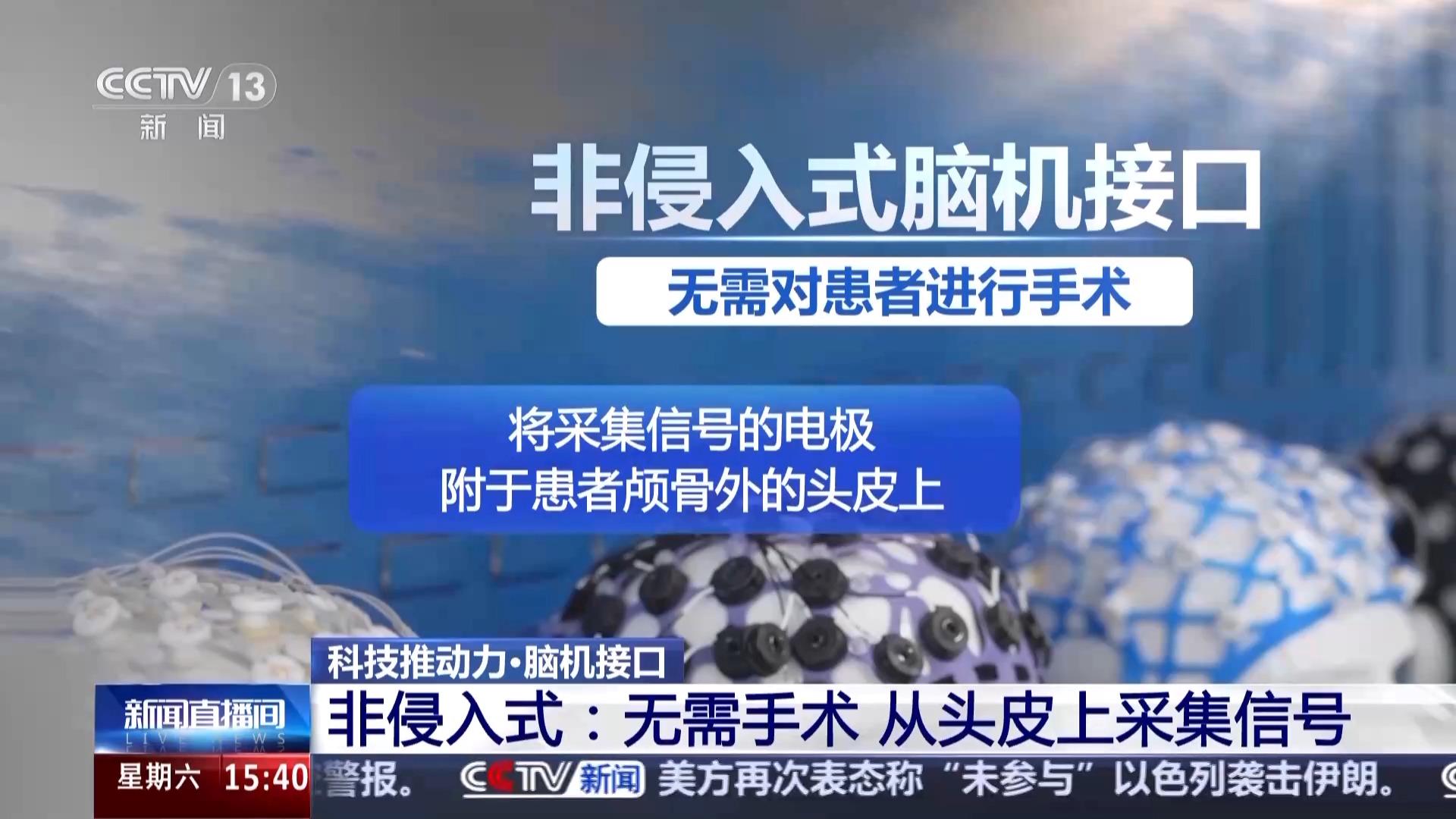 为意念装上现实“臂膀” 脑机接口助力“心想”到“事成”