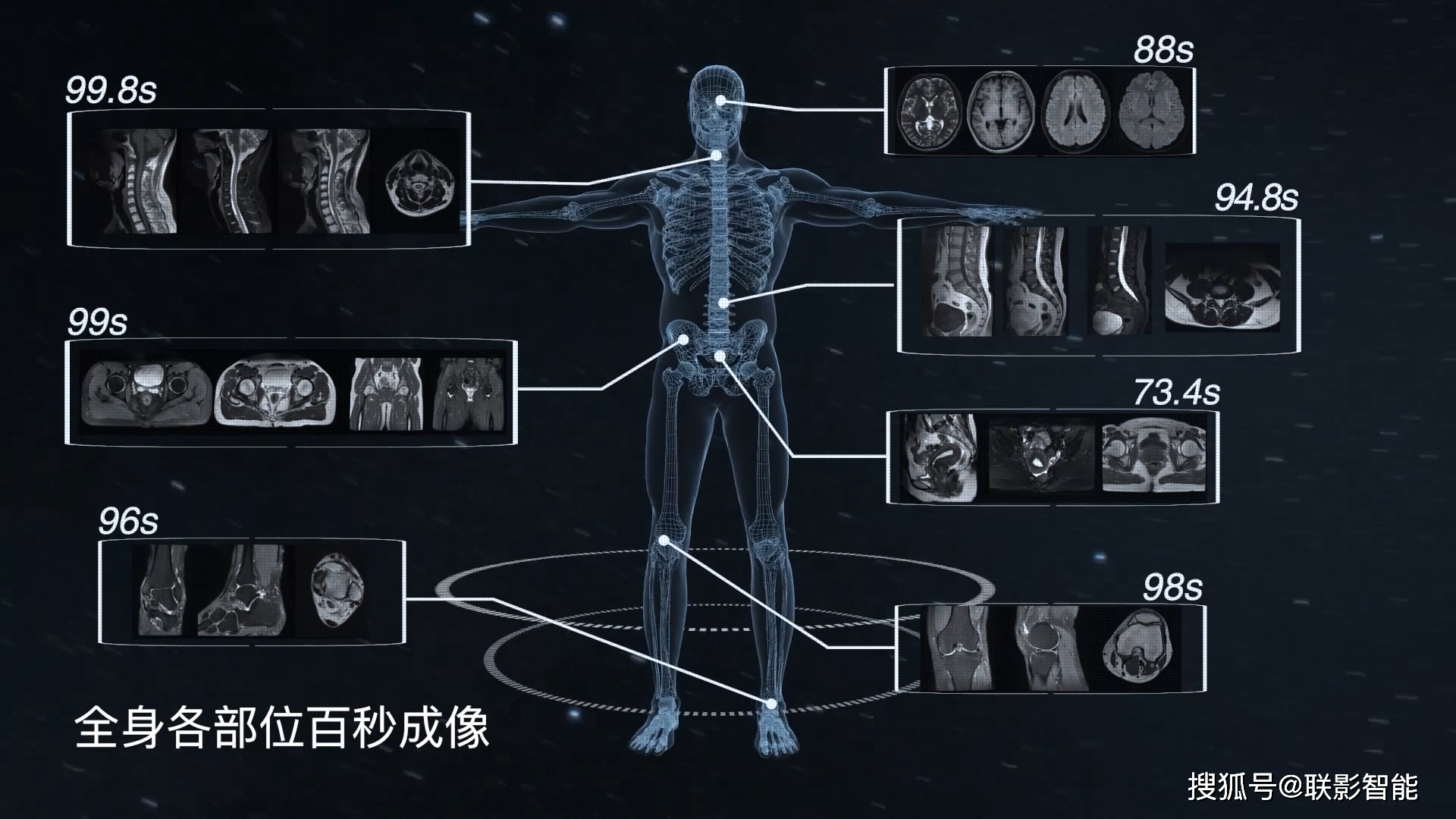 联影医疗正式进入超声赛道 以AI赋能超声产品线