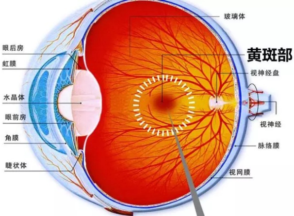 糖尿病视网膜病变成隐形“致盲杀手” 专家称应及时筛查、尽早防治